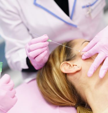 Microneedling