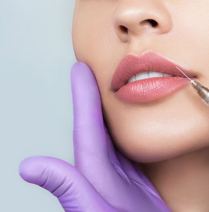 Nahaufnahme einer Lippenunterspritzung
